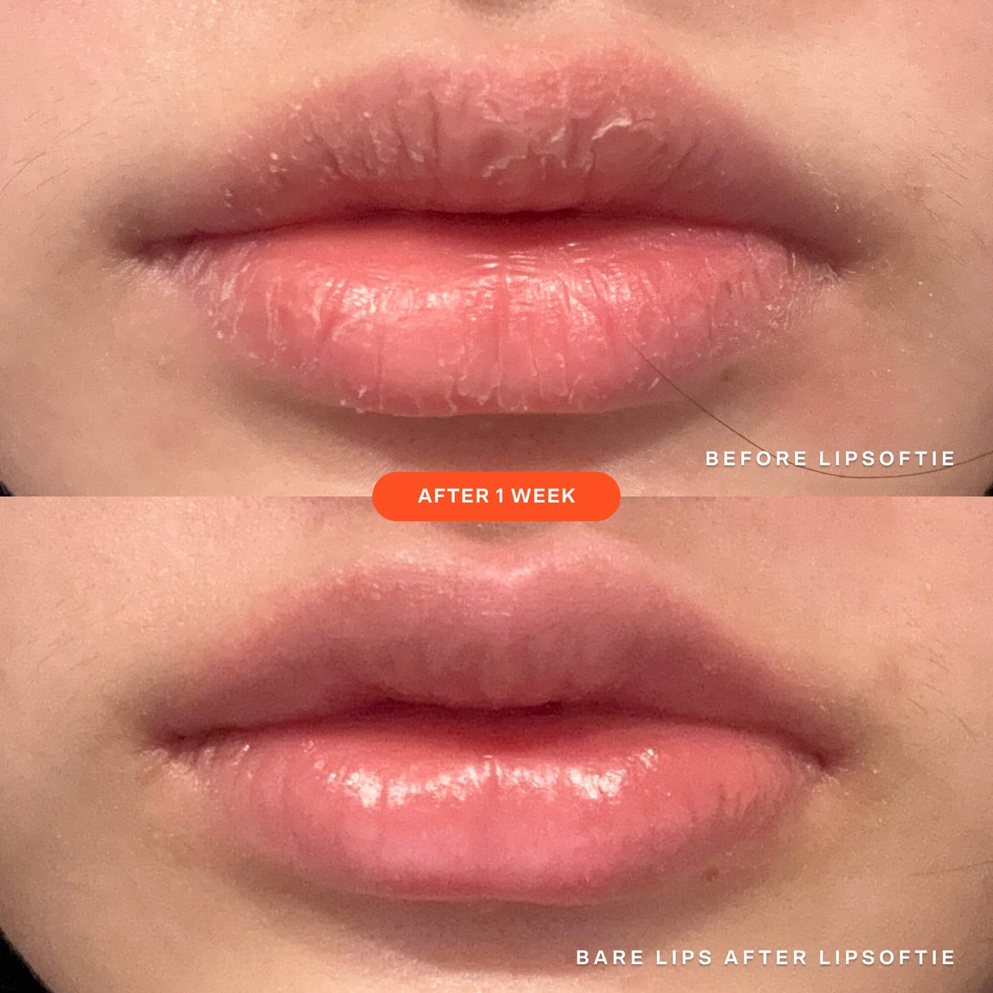 [Shared: A before and after image of the same lips showcasing the effectiveness of Tower 28 Beauty's LipSoftie™ Lip Treatment after one week of use]